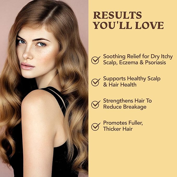 Eczema & Psoriasis Shampoo & Conditioner Set For Men & Women (2 Pack)-Aloe Vera & Manuka Honey for Gentle Itchy, Dry Scalp Treatment-Dandruff, Seborrheic Dermatitis, Sulfate-Free, Hypoallergenic 8oz