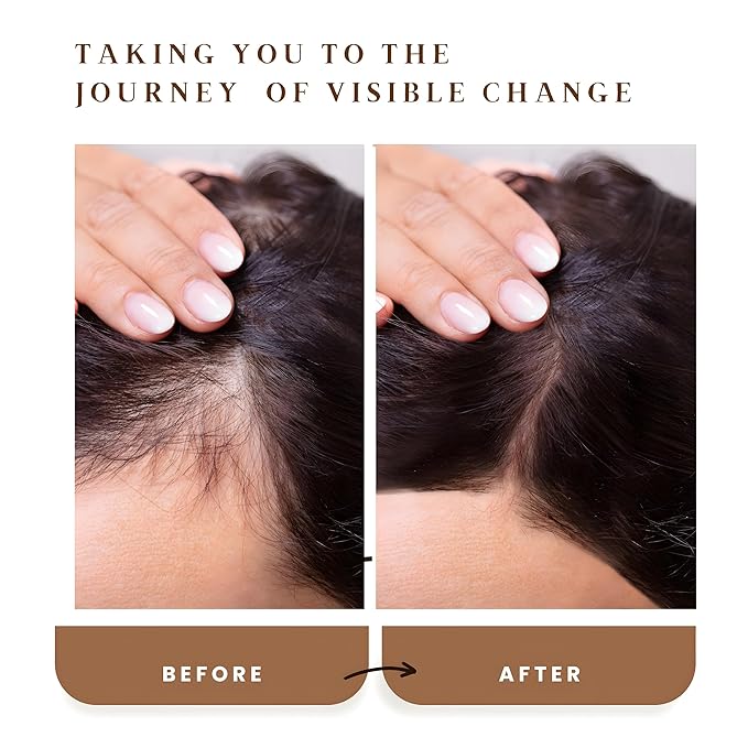 Rosemary Oil for Hair Growth – Hair Loss & Regrowth Treatment – Scalp Treatment – Strengthens Roots, Prevents Split Ends, Infused with Botanicals – Hair Serum for Dry Hair – 1.7oz – The Oily Tonic