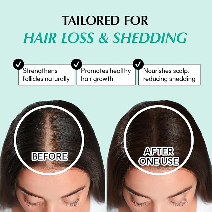RATED GREEN REAL GROW Anti Hair Loss Stimulating Scalp Spray for Hair Growth, Korean Hair Care, Cold Brewed Organic Rosemary Water Spray for Thinning Hair, 6.06 Fl. Oz