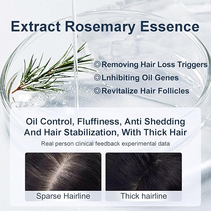 Organic Biotin & Rosemary Hair Growth Shampoo – Thickening Shampoo with Amino Acids for Hair Loss, Dandruff Control & Oily Scalp - for Women & Men