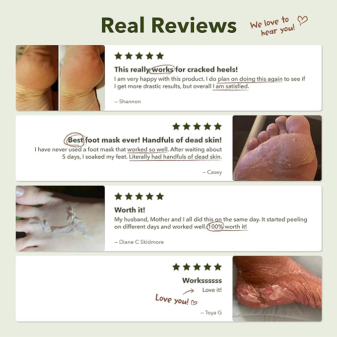 Purederm Shiny & Soft Foot Peeling Mask (3 pack) - For smooth and moist baby skin with Exfoliating peel off Calluses, Dry Skin, Cracked Heels - Men and Women