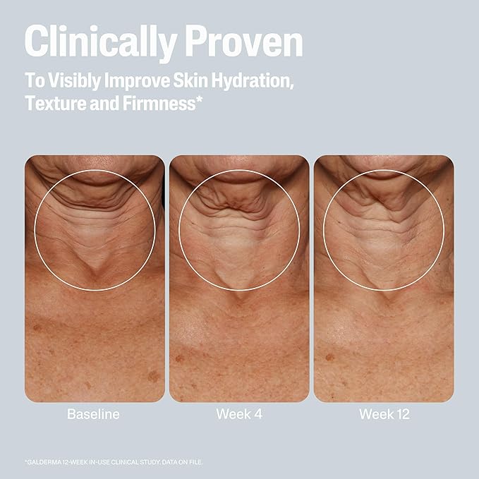 Cetaphil Skin Activator Hydrating & Firming Body Lotion 16oz, Mandelic Acid (AHA) and Centella Asiatica (CICA) Body Moisturizer, Hydrates and Firms Aging Skin, Anti-Aging Body Care