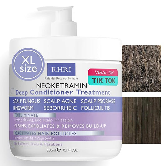 Anti Fungal Deep Conditioner for Men and Women | Scalp Treatment for Psoriasis, Dandruff, Seborrheic Dermatitis | Provides Relief from Folliculitis, Eczema, Itchy, Flaky and Dry Scalp