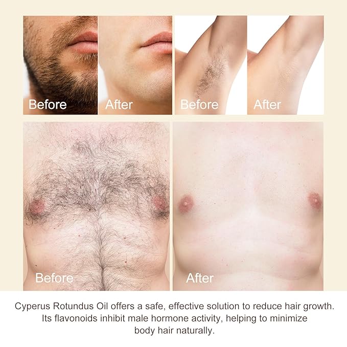 Cyperus Rotundus Oil for Hair Removal, 100% Natual Cyprus Rotundus Oil Cypress Oils Hair Inhibitor, Reducing Body Hair Growth, Moisturizes & Soothes Skin, Shrink Pores, For All Skin Types, 2.02 Fl.Oz