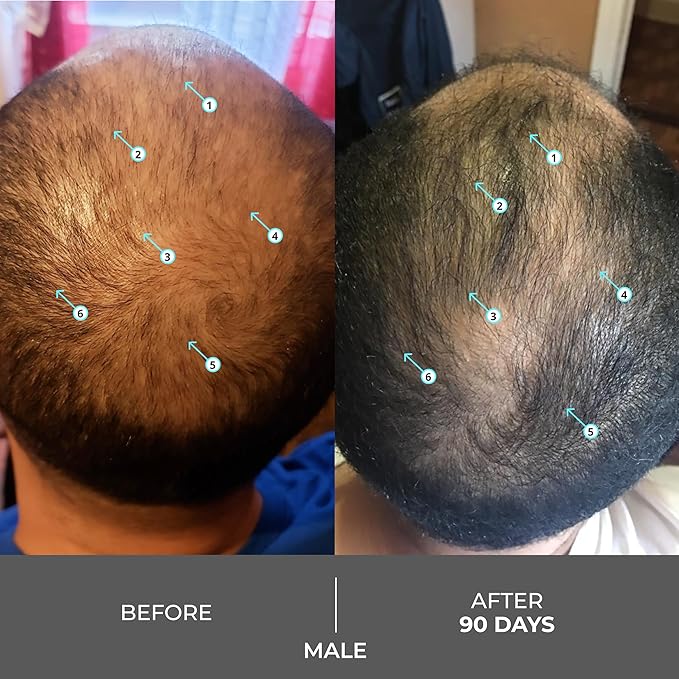 DS Labs Revita Extra Strength Shampoo, 205mL – Scalp First Cleanse for Fuller, Thicker Looking Hair, Lightweight Hydration, Sulfate Free, Color Safe, For Men & Women