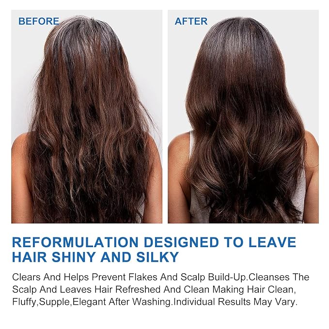 Ceson&Cesun Anti-Fungal/Anti Dandruff 2 in 1 Shampoo for Folliculitis, Scalp Psoriasis & Seborrheic Dermatitis, Itchy & Dry Scalp Relief, Nourishes, Hydrates, Fresh Scent, Safe For Color-Treated Hair