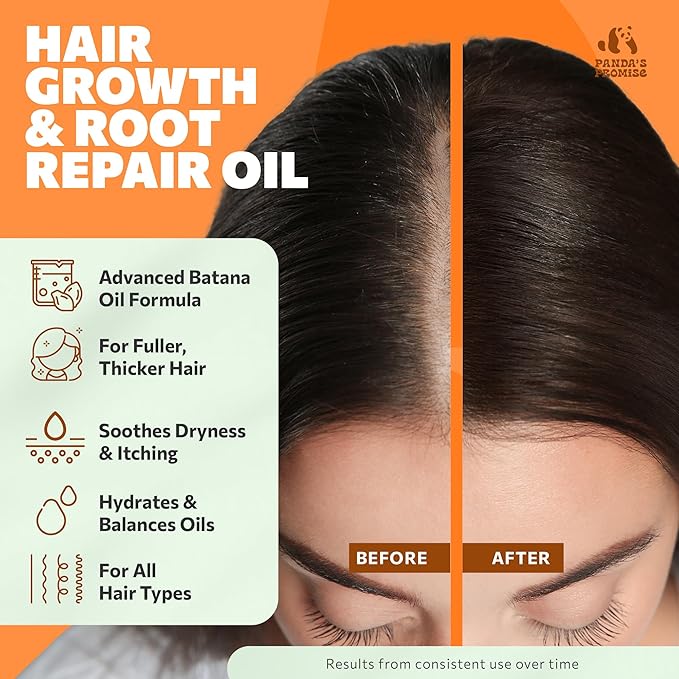 Panda's Promise Batana Oil for Hair Growth with Rosemary Oil, Jojoba Oil & Castor Oil- Natural Dry Scalp Treatment Product for Thinning (2 x 50ML = 100ML)