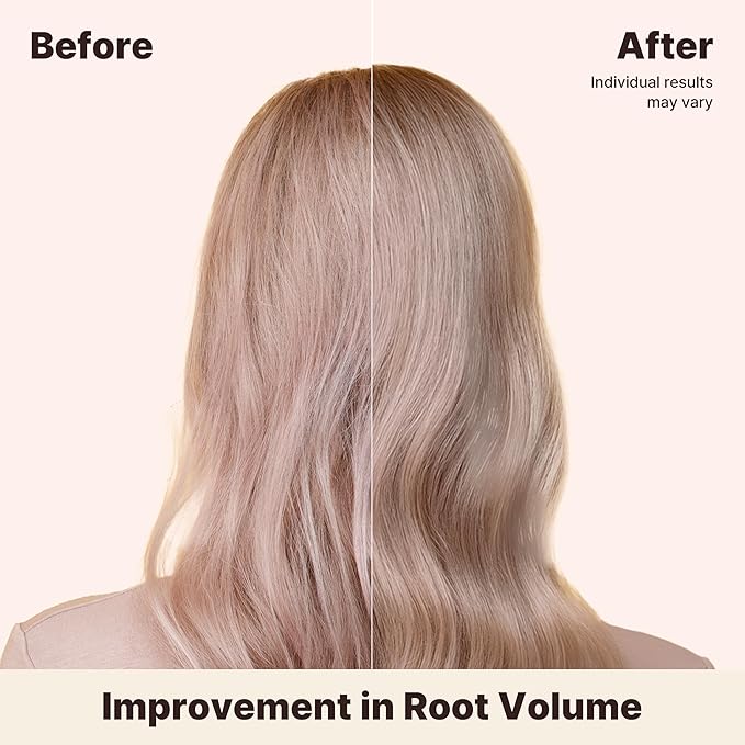 Nutrition Volume Conditioner for Damaged Hair – Biotin, Niacinamide & Panthenol for Strength, Cuticle Repair, Elasticity & Shine – Citrus Vanilla Scent, 6.7 fl oz, Korean Scalp Care Technology