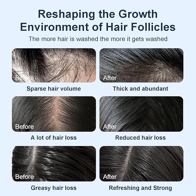 Organic Biotin & Rosemary Hair Growth Shampoo – Thickening Shampoo with Amino Acids for Hair Loss, Dandruff Control & Oily Scalp - for Women & Men