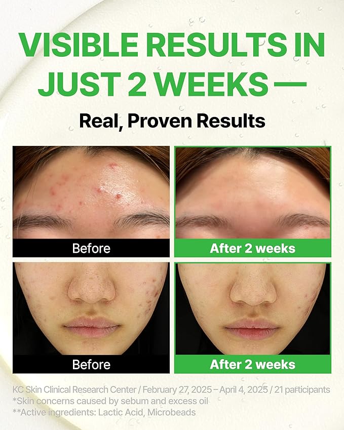 Trouble Control Pad | Korean Toner for Oily, Sensitive & Acne-Prone Skin – Exfoliating Facial Pads with Dual Cotton Rounds & Calming Botanicals (70 Pads)