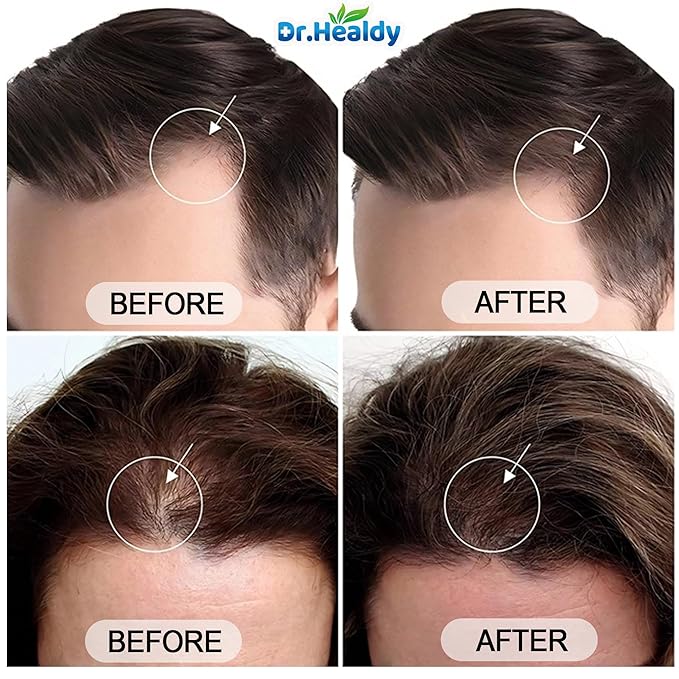 Dr.Healdy Batana Oil Shampoo for Hair Growth, Against Hair Loss & Moisturizes, Reduces Breakage - Sulfate Free Formula for All Hair Types (6.8 Fl Oz)