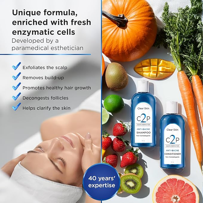 Non-Comedogenic Hair Conditioner by Clear 2 Perfection – Ideal for Acne-Prone Skin, Bacne & Sensitive Scalps – Non Clogging Conditioner