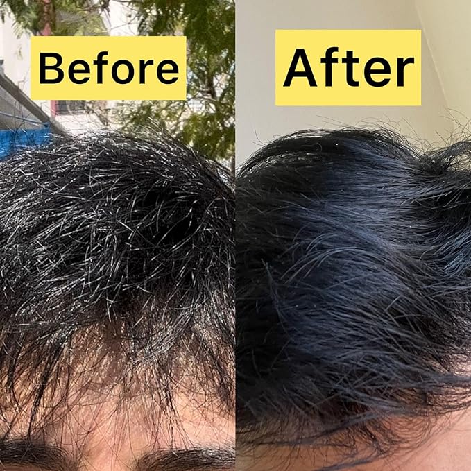 Transparent Hair Oil Treatment, To Support Thicker, Voluminous, Fuller Looking Hair, Infused with Hyaluronic Acid, Biotin, Avocado and Rosemary Oil (3.4 Fl Oz)