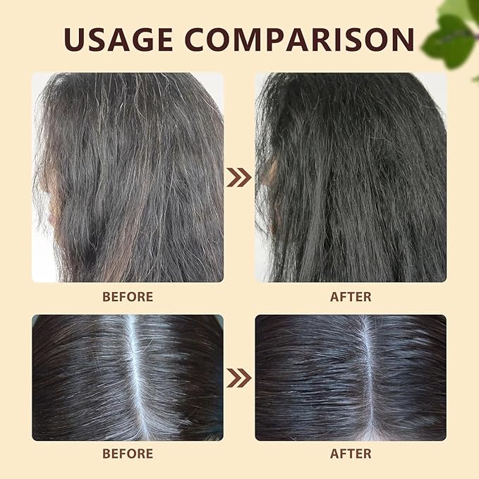 Root activating shampoo, hair growth soap, deep cleansing scalp, natural formula, with moisturizing and scalp care effects, suitable for men and women to use