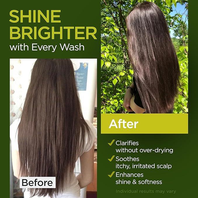 Tea Tree Rosemary Shampoo and Conditioner Set with Castor Oil for All Hair Types - Effective Cleanse and Supports Scalp Health for Women & Men Paraben & Sulfate Free (16 Oz Each)