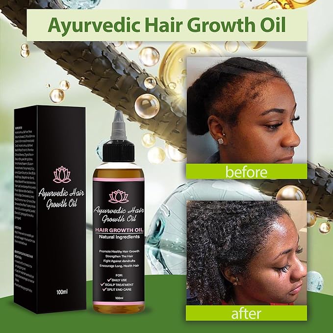 Hair Care Growth Oil, Ayurvedic Hair Growth Oil with Rosemary, Fenugreek, Cloves and Hibiscus, Natural Herbs Scalp Oils, Lightweight for All Hair Types (1 Pack)