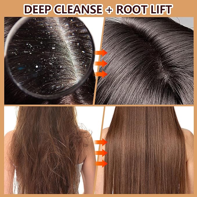 Scalp Scrub with Batana Oil, 2-in-1 Shampoo Scalp Exfoliator for Hair Treatment, Includes Silicone Scalp Massager, Removes Buildup & Dandruff, 10.6oz