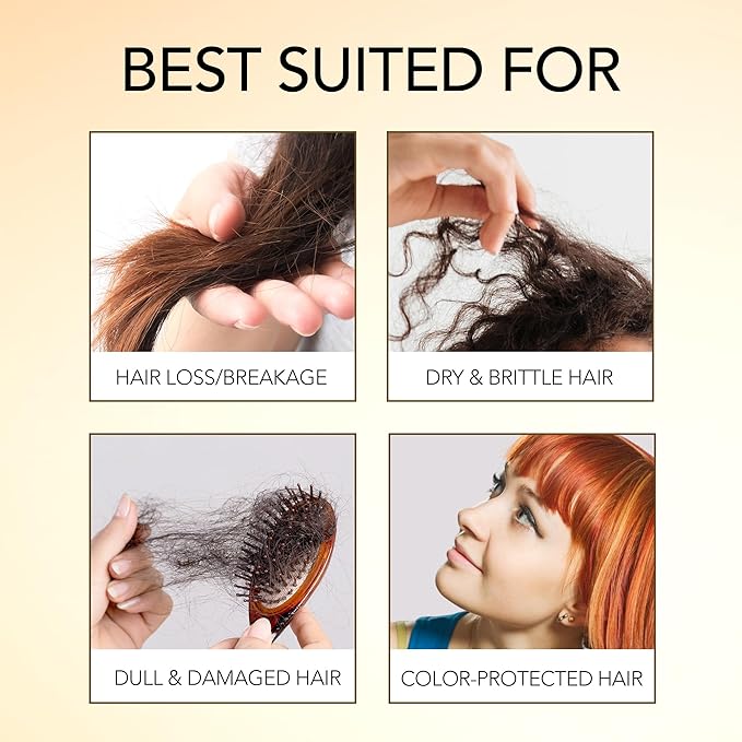 Botanic Hearth Rosemary, Coconut & Avocado Oil For Hair Growth (6.7 fl oz) Infused with Rosemary, Coconut, Biotin|Hair Oil Repairs Damaged Hair, Strengthening, Healthier Hair, Moisturizing- Hair Tonic