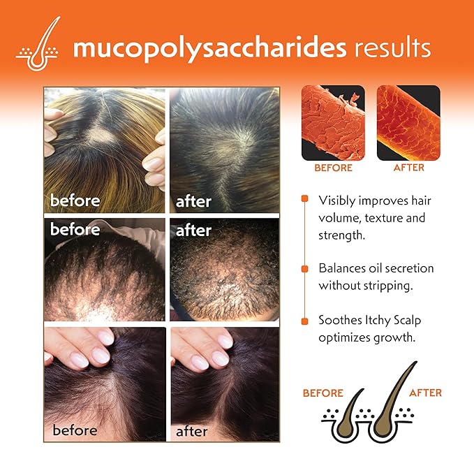 Regrowth Hair & Scalp Conditioner with Biotin, Aloe Vera, Tea Tree Oil & Mucopolysaccharides (natural polysaccharide) to Provide Shine & Volume, Detangler, 8 oz