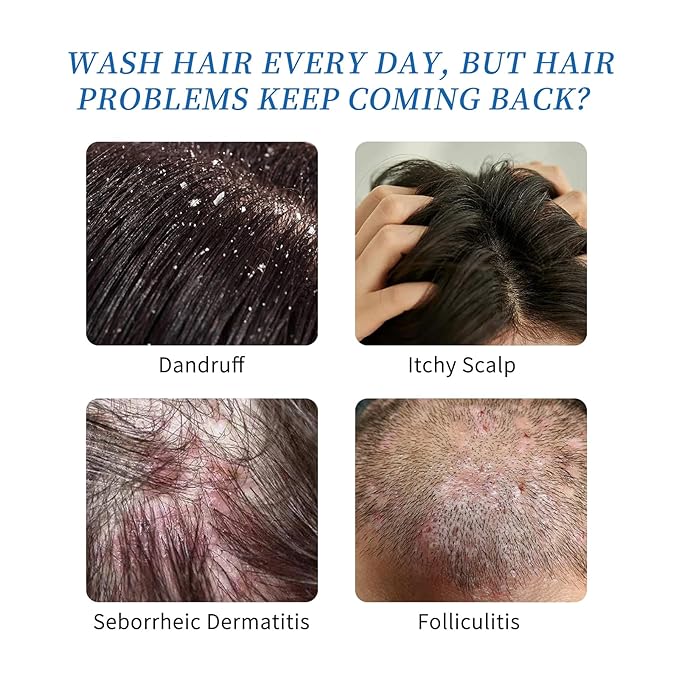 Ceson&Cesun Anti-Fungal/Anti Dandruff 2 in 1 Shampoo for Folliculitis, Scalp Psoriasis & Seborrheic Dermatitis, Itchy & Dry Scalp Relief, Nourishes, Hydrates, Fresh Scent, Safe For Color-Treated Hair