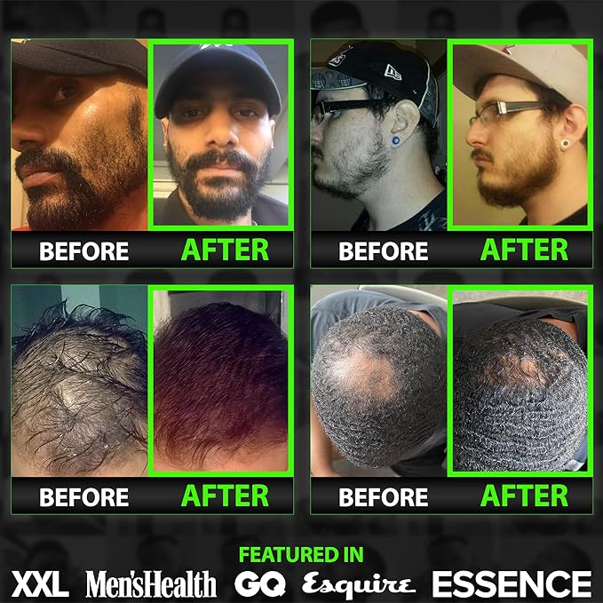 GROW Hair & Beard Wash 11-in-1 – Beard Wash & Conditioner + Beard Growth Shampoo with Biotin, Castor Oil, Peppermint, Keratin – Supports Hair & Beard Growth