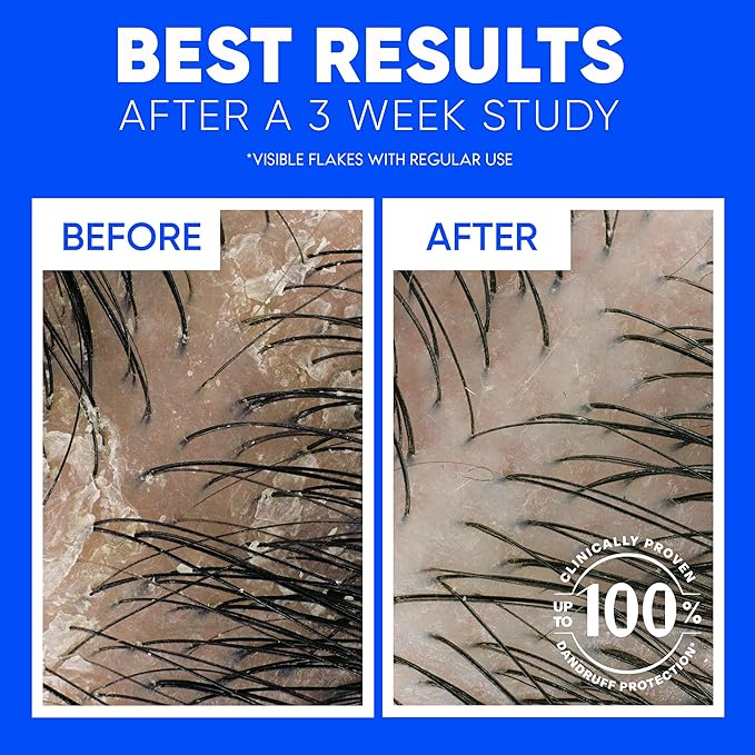 Head & Shoulders 2-in-1 Classic Clean Anti-Dandruff Shampoo & Conditioner Twin Pack, Paraben-Free, Color-Safe, Fresh Scent, 32.1 Fl Oz (Set of 2)